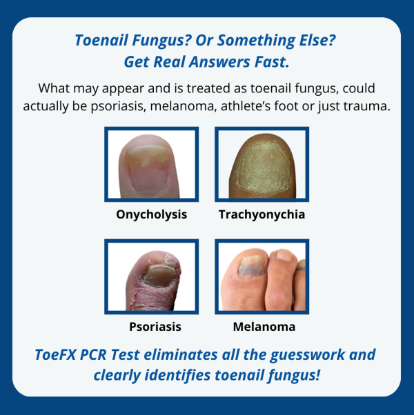 Professional Clinic PCR Fungus Test - 10 packs + free shipping - Image 4