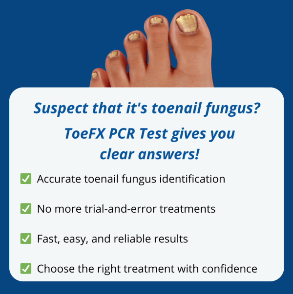 Professional Clinic PCR Fungus Test - 10 packs + free shipping - Image 2