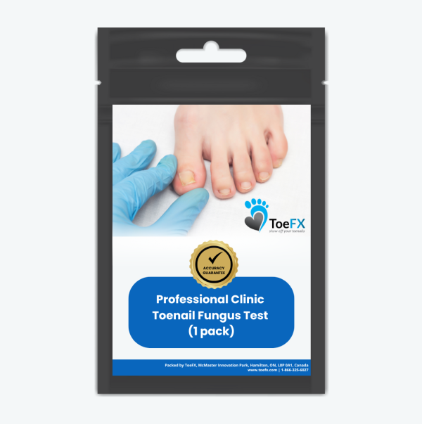 Professional Clinic PCR Single Fungus Test + free shipping