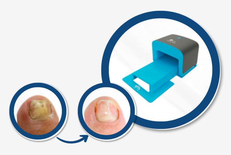 ToeFX Gill Podiatry AAPPM 2024